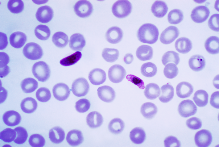 Virus de la malaria