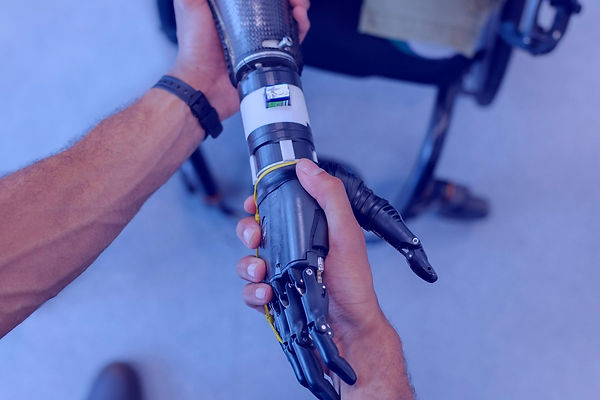 Mechanical engineer aids with prosthetic