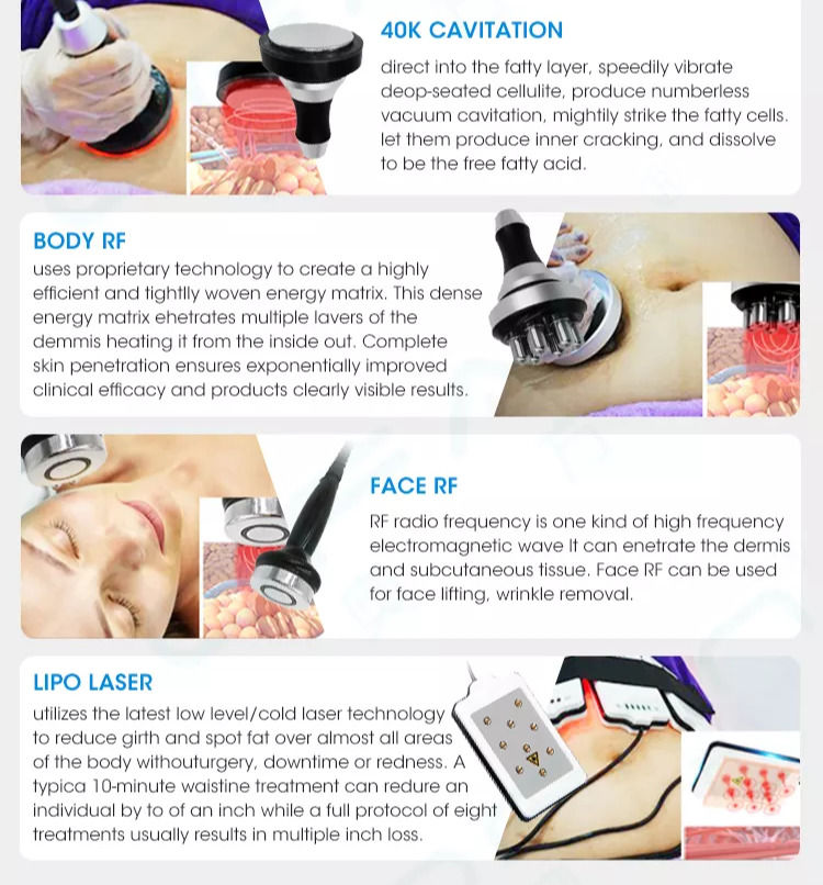 Thumbnail: 360° Cyrolipolysis Slimming Machine