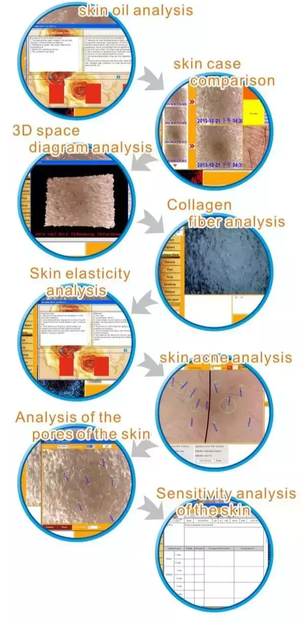 Thumbnail: Digital Skin Analyzer Facial Scanner