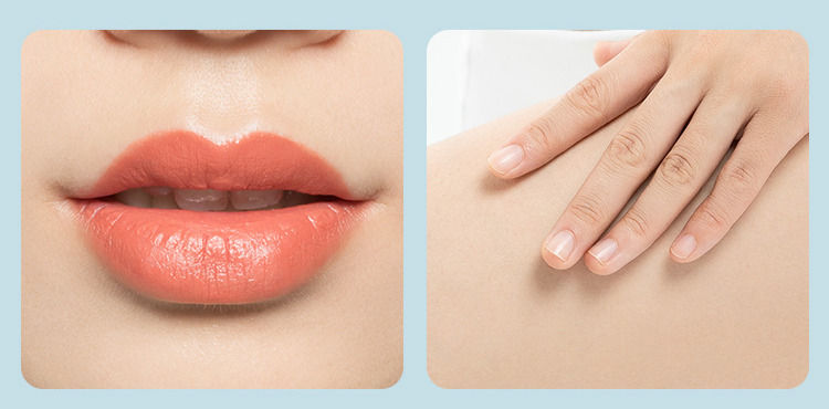 Thumbnail: IPL Laser Hair Removal