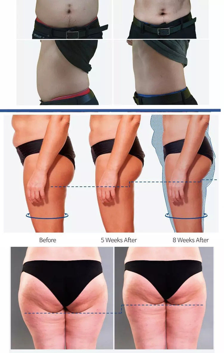 Thumbnail: HI-EMT Pro Fat Burning Technology