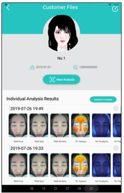 Thumbnail: Facial Analysis Skin Analyzer