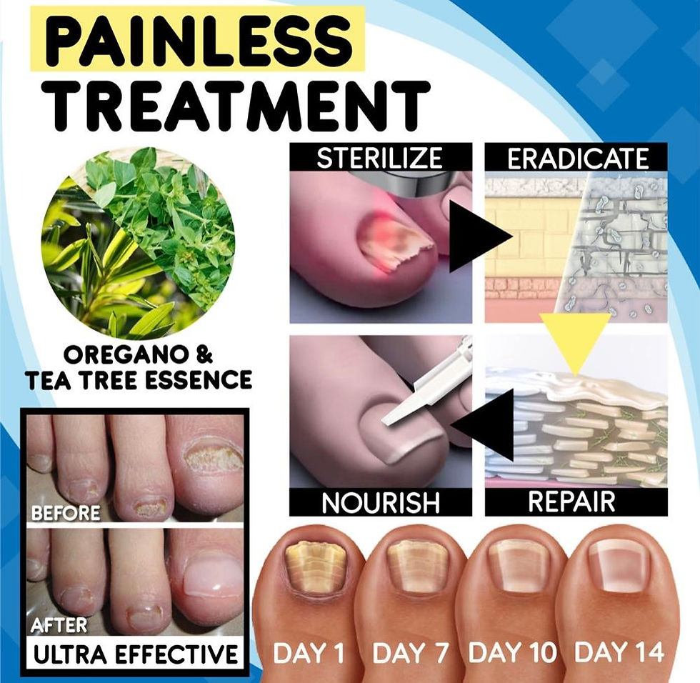 Thumbnail: Anti-Fungal Home Treatment Set