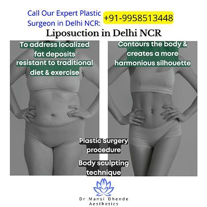 What does liposuction do?