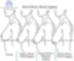 Diagrammatic sketch showing Degree of Breast Ptosis (Breast Sagging) in Women