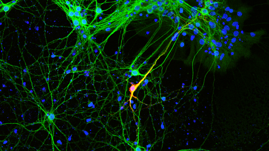 Protein Synthesis Dynamics | Shrestha Lab | Stony Brook