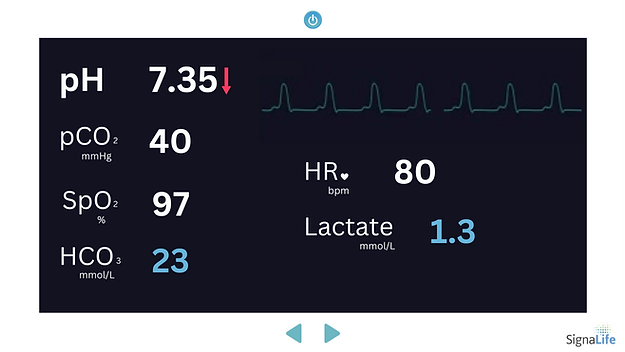 monitor lact 1.3
