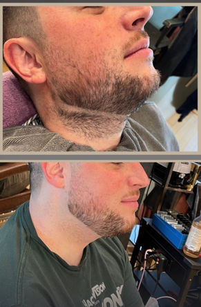 Before and after photo of mens beard trim with razor sharp lining and defined edges.