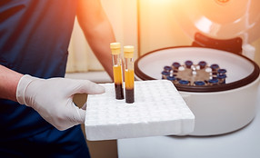 Platelet Rich Plasma (PRP)