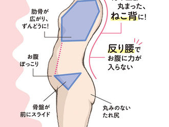 産後、腹筋の緩みが背中の痛みの原因になる?