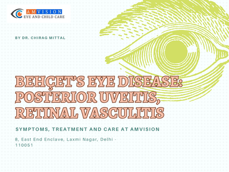 Behcet's Eye Disease