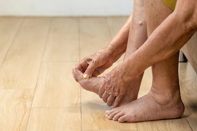 elderly-woman-massage-her-foot-with-painful-swollen-gout-inflammation_176124-2530.jpg.webp
