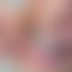 Invisalign in Rancho Bernardo: How Clear Aligners Fit Into a Modern Cosmetic Smile Plan