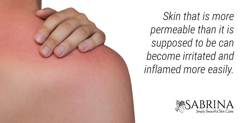 SensitiveSkin-Rash
