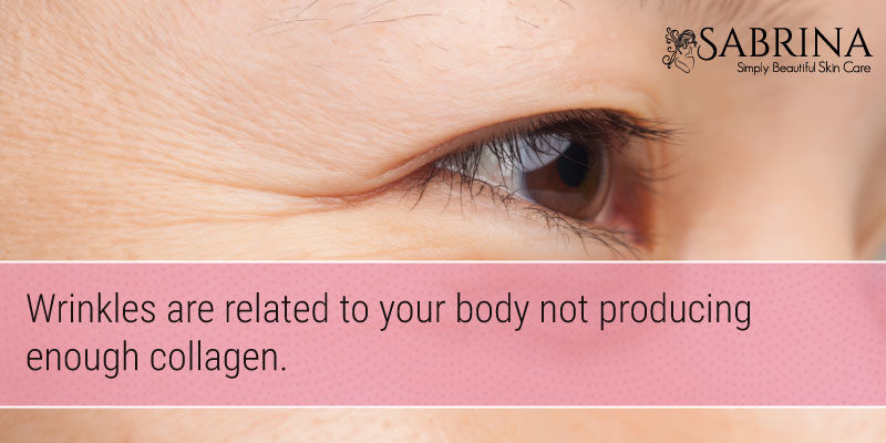 NaturallyBeatifulSkin-Wrinkles