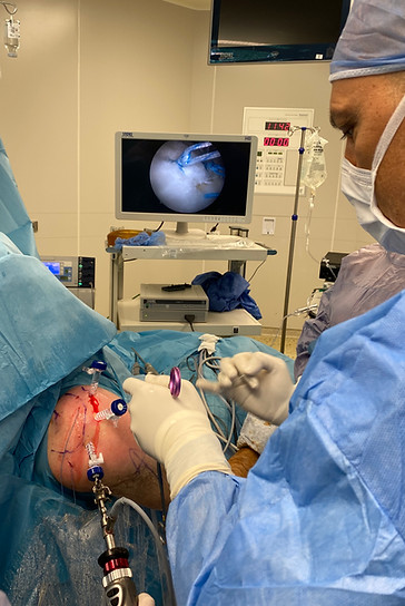 Dr. Bilen shoulder arthroscopy