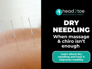dry needling on a back of a patient to remove tension points