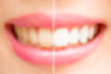 AdobeStock_88252089.jpeg