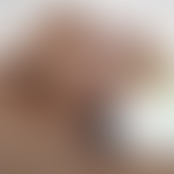 XERF SKIN TIGHTENING — No Numbing, No Pain, No Downtime. Just Results.