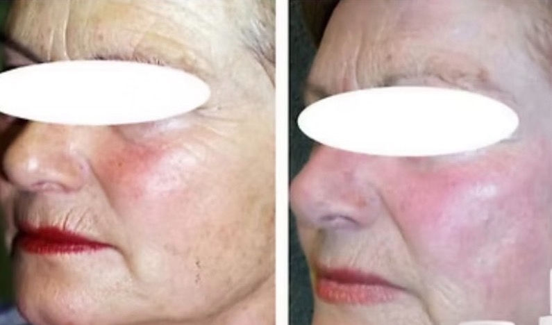 Flash Facial medi-derma Revitalizing Protocol Jacksonville