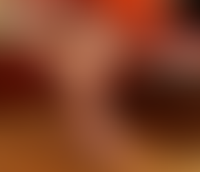 How to Fade and Prevent Dark Spots After Waxing: Esthetician-Approved Tips