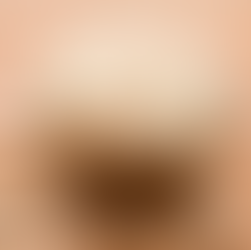 10 Incredible Health Benefits Of Fox Nuts You Didn't Know About