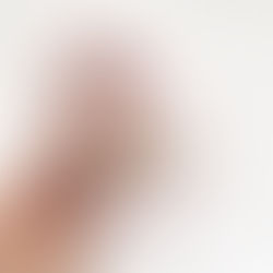 サプライズ 3 + 栗