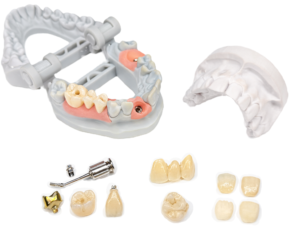 Digital implant crown and bridge restorations with zirconia and lithium disilicate glass-ceramic materials