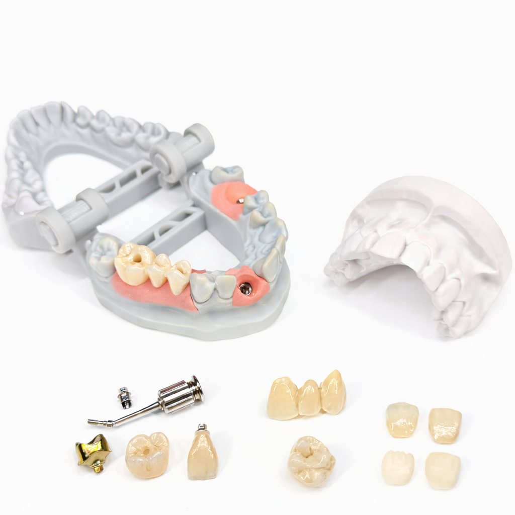 Digital implant crown and bridge restorations with precision fit and natural esthetics