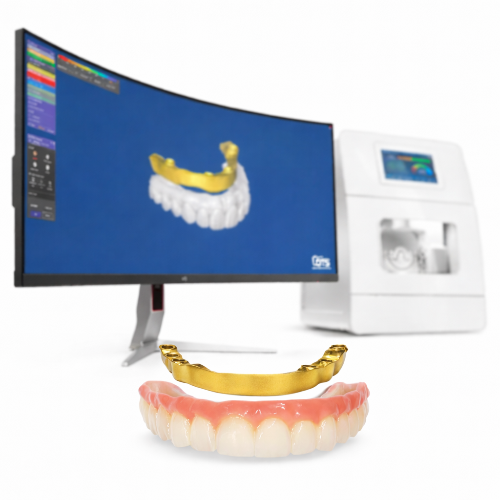 All-on-X full arch implant planning and prosthetic workflow