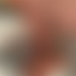 Day 3 of Healthy Summer Treats: 🍉Watermelon Shaved Ice #SummerOnShorts