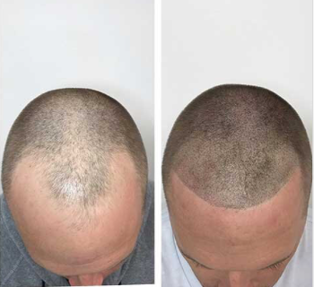 Schedule your consultation today!