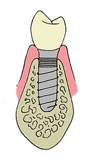 marshalltown iowa dentist dentistry dental office implants