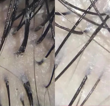 HEAD SPA WEBSITE PIC_edited_edited_edited.jpg