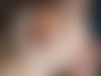 ¿Brote o epidemia de sarampión en Chihuahua?