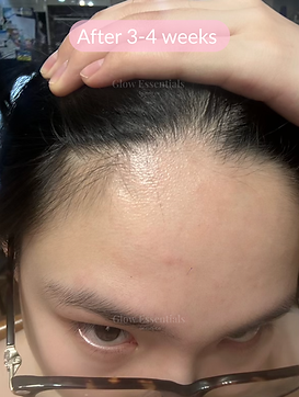 high freq customer image after.png