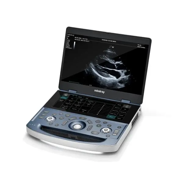 Mindray Portable Ultrasound System MX7