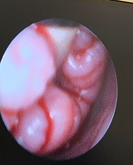 Cervix.JPG