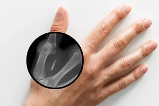 Washington Prohibits Employer-Mandated Microchipping