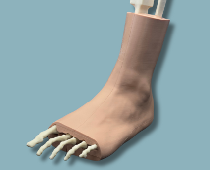 Pied-et-demi-tibiafibula-Addi-CAN-fracture-fibula-pilon-tibial-calca-Addi-SKIN-Ref