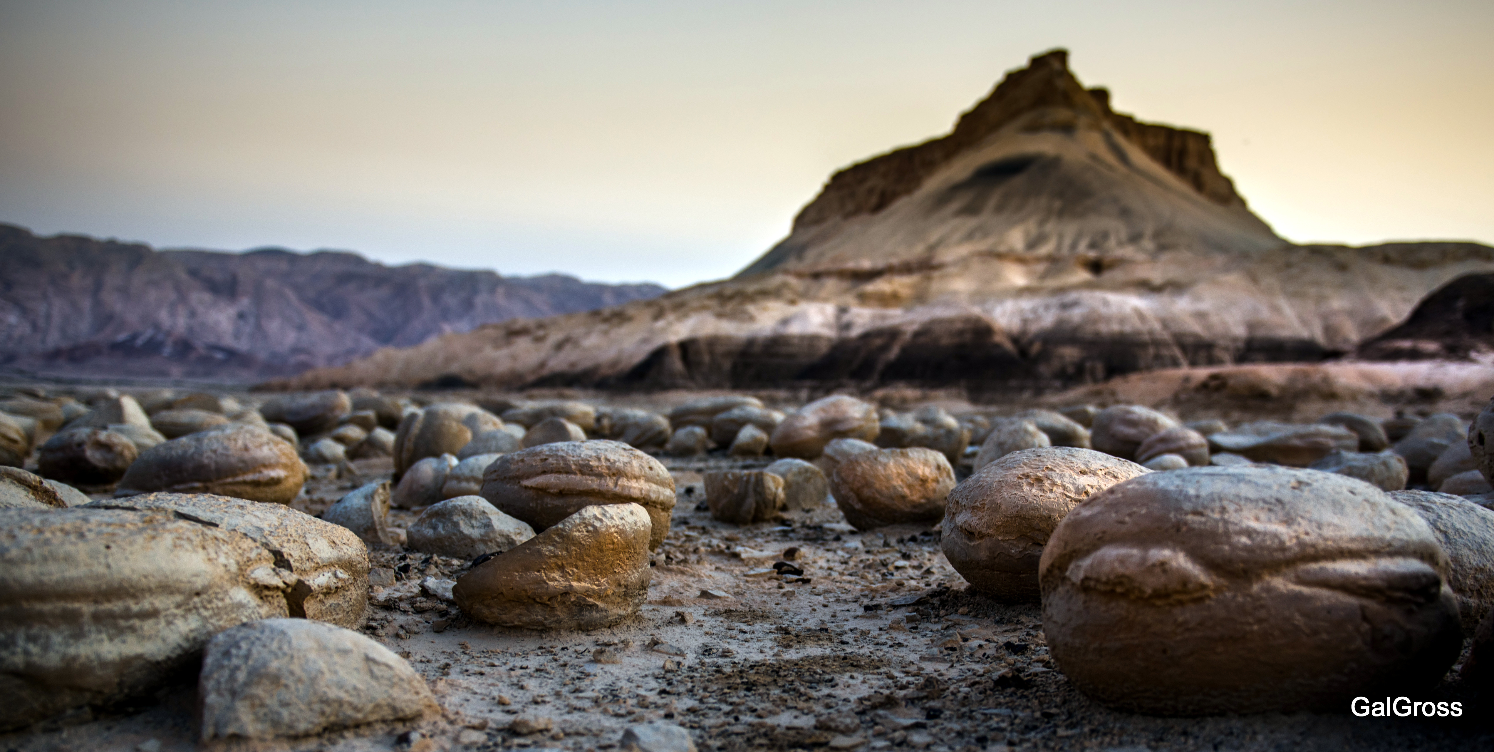 Hamburger stones