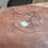 Thumbnail: Diffuser Lens