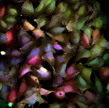 22_Transfected_cells_INTEGRARE.png