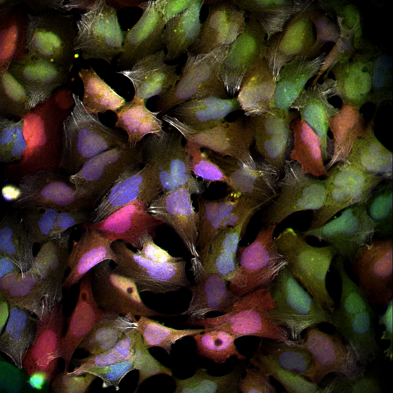 22_Transfected_cells_INTEGRARE.png
