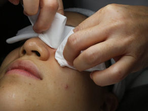 The Ultimate Guide to Finding the Best Extraction Facial for Your Skin Type