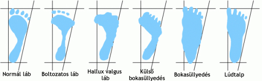 normalfuss_vergleich_hun.gif