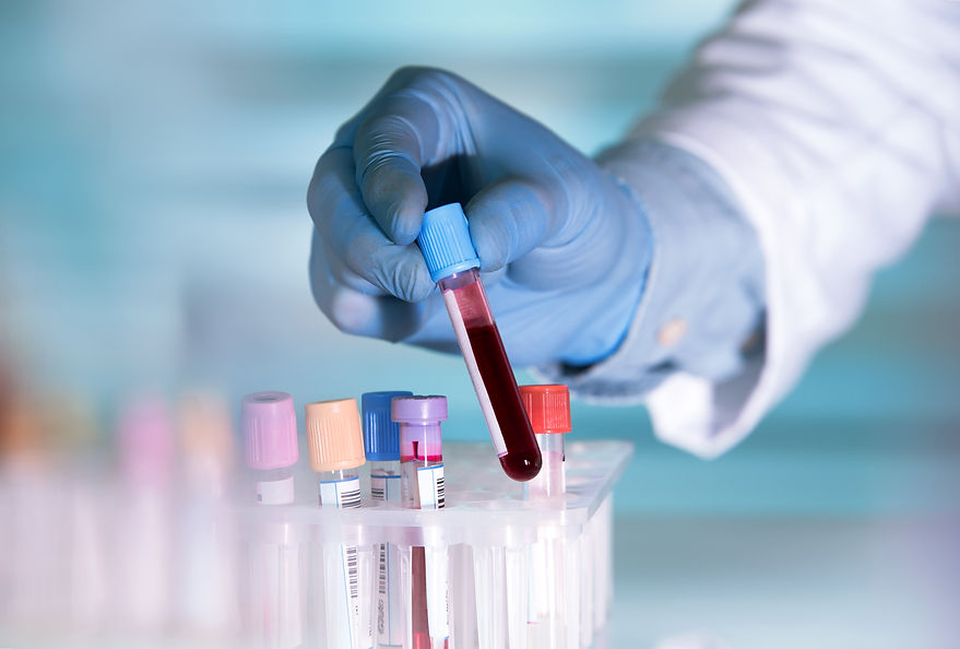 lab technician holding blood tube sampl