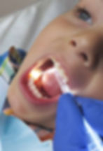 Asentcare Dental Products Annuces Issuance of Patent