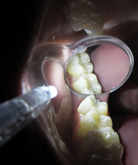 Fiber Optics: A Must For Your Dental Practice